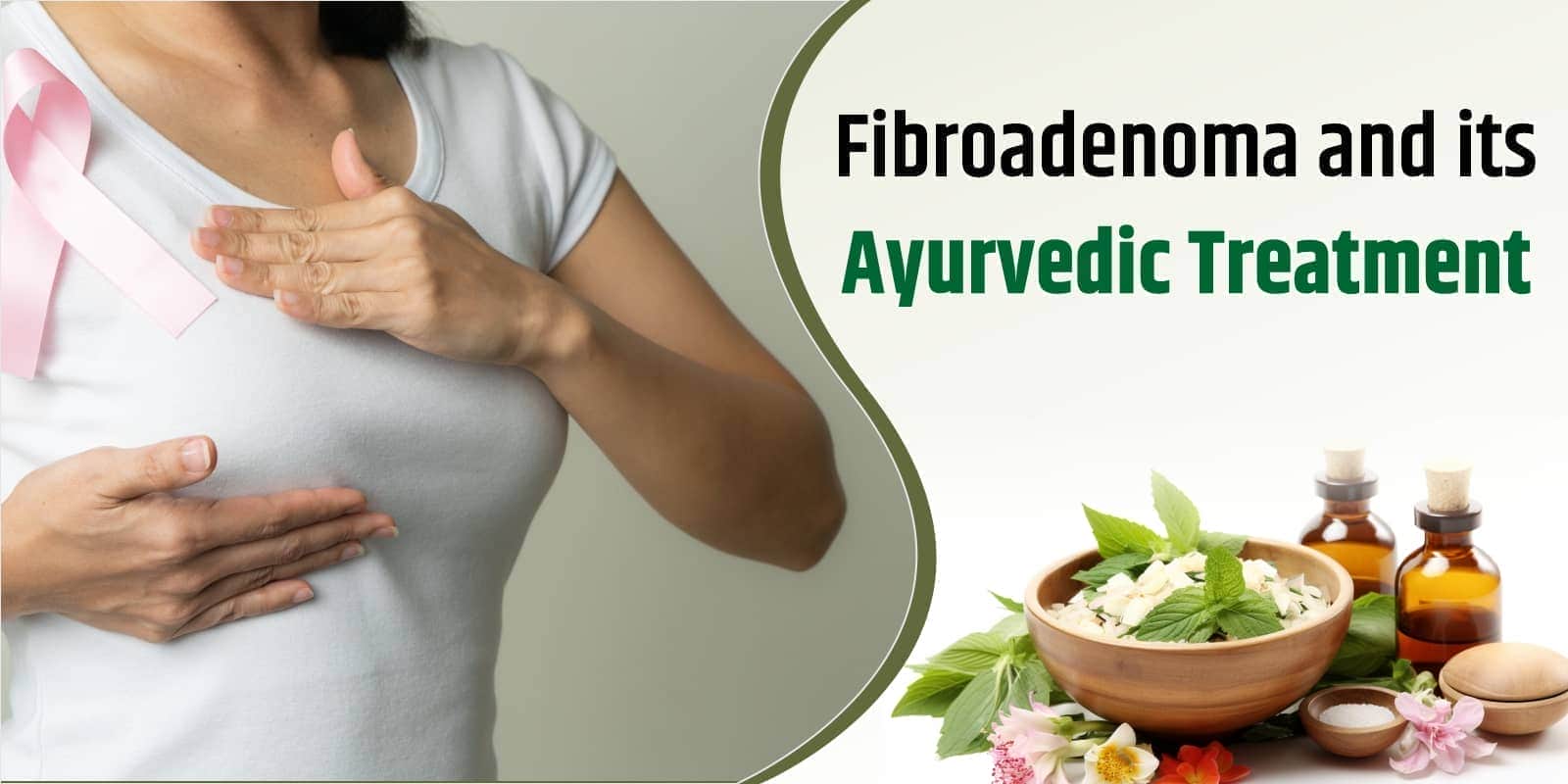 Fibroadenoma and its Ayurvedic Treatment
